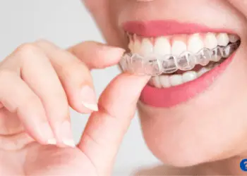 How Much Does Invisalign Cost?