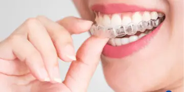 How Much Does Invisalign Cost?