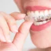 How Much Does Invisalign Cost?