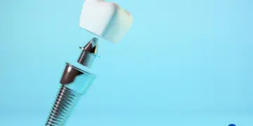 How Much Does a Tooth Implant Cost?