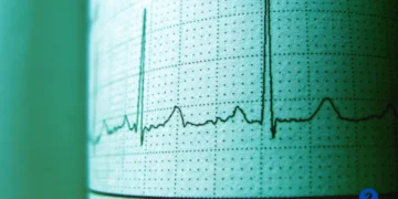 How Much Does Polysomnography Cost?