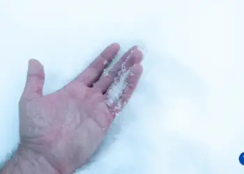 How Much Does It Cost to Treat Frostbite?