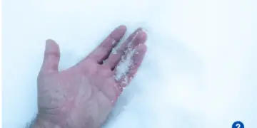 How Much Does It Cost to Treat Frostbite?