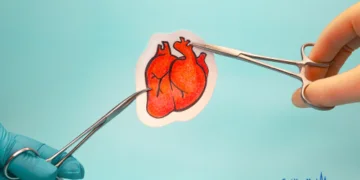 How Much Does Heart Surgery Cost?
