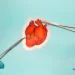 How Much Does Heart Surgery Cost?