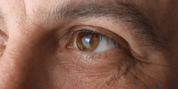 How Much Does Cataract Removal Cost?