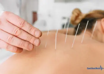 How Much Does an Acupuncturist Cost?
