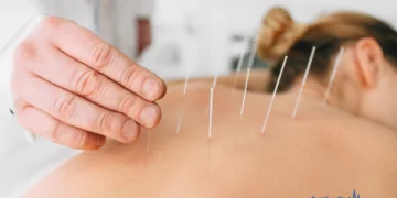 How Much Does an Acupuncturist Cost?