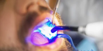 How Much Does a Dental Filling Cost?