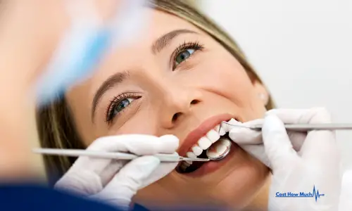How Much Does a Dental Cleaning Cost?