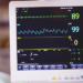 How Much Does an EKG Test Cost?