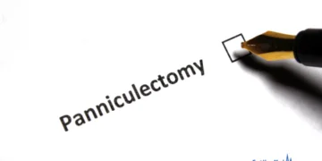 How Much Does a Panniculectomy Cost?
