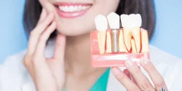 How Much Does a Dental Implant Cost?