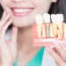 How Much Does a Dental Implant Cost?
