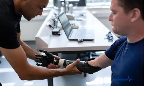 How Much Does a Prosthetic Arm Cost?